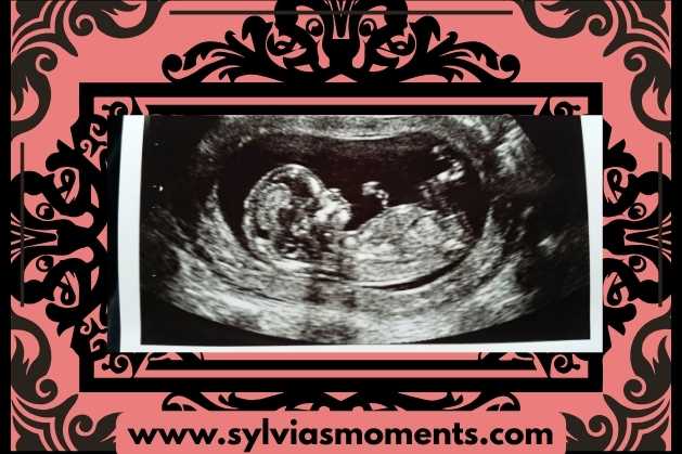 ultrasound-image-framed-15-Unique-Pregnancy-Announcement-Ideas-to-Surprise-Your-Husband