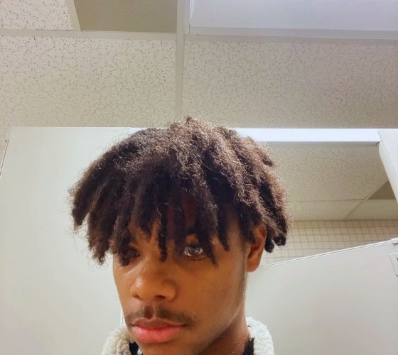 puffy-and-swollen-locs.