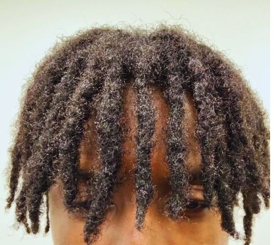 visible-knots-forming-5-different-stages-of-locs-and-what-to-expect