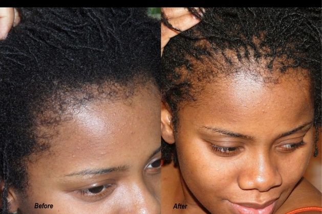 maintainance-of-sisterlocks-Honest-Pros-and-Cons-of-Sisterlocks-What-Nobody-Tells-You-Before-Getting-Them