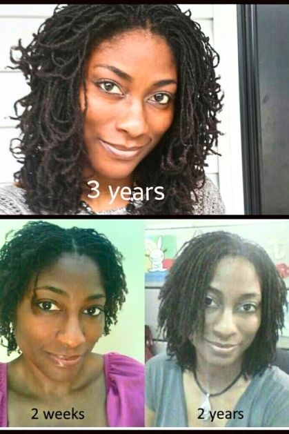 sisterlock-hairgrowth-rotation-Honest-Pros-and-Cons-of-Sisterlocks-What-Nobody-Tells-You-Before-Getting-Them